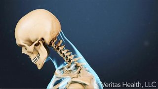 Neck Strain and Poor Posture